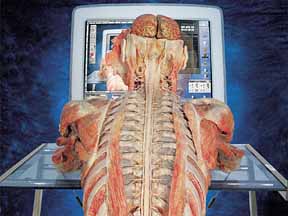 Gunther von Hagens
